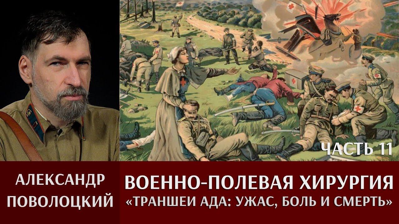 Александр Поволоцкий. Военно-полевая хирургия. Часть 11. "Траншеи ада: ужас, боль и смерть"