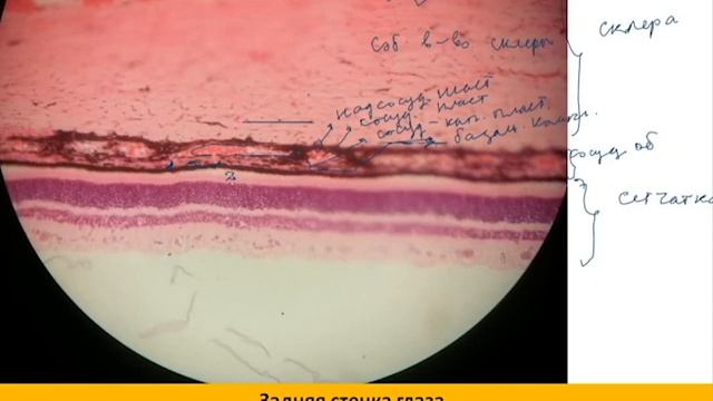 Задняя стенка глаза гематоксилин эозин
