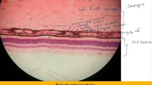 ЗАДНЯЯ СТЕНКА ГЛАЗА | Разбор гистологического препарата