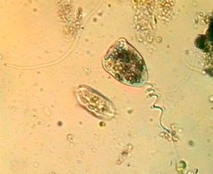 ДВИЖЕНИЕ С ПОМОЩЬЮ  РЕСНИЧЕК И ЖГУТИКОВ