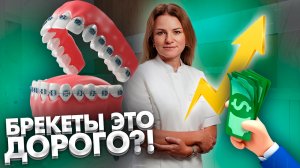 Брекеты - это дорого? Брекеты. Исправление прикуса. Ортодонт.