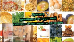 Эрозия двенадцатиперстной кишки: симптомы и лечение