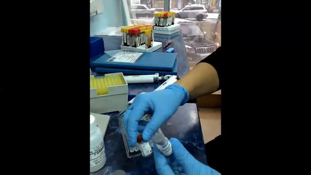 Особенности работы с набором для диагностики сифилиса SERODIA TP-PA смотреть онлайн