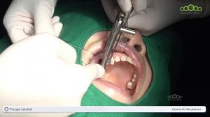 [MULTI_SUB] Immediate implant with core lift with universal kit - [Dr. Kim Jaeyoon]