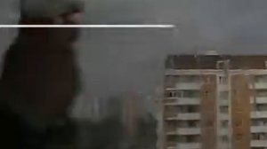 Термические и химические ожоги