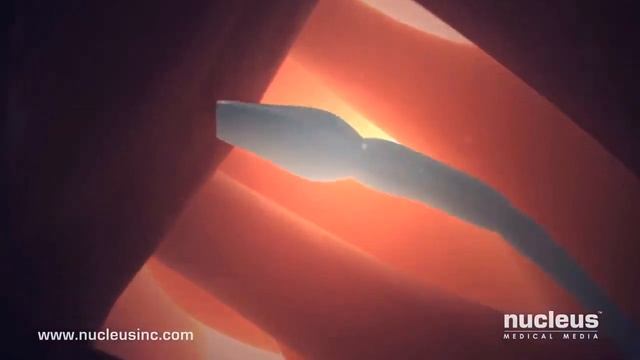 ⛲ ЗАЧАТИЕ РЕБЁНКА (ОПЛОДОТВОРЕНИЕ ЯЙЦЕКЛЕТКИ) смотреть онлайн