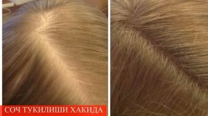 СОЧ ТУКИЛИШИНИ ОЛДИНИ ОЛИШ ТЕЗ ВА ОССОН