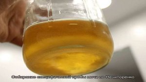 Как правильно сдавать мочу при беременности