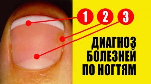 Болезни ногтей на руках фото и описание