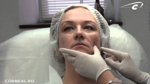 Как выбрать точку доступа для канюли? PRINCESS.