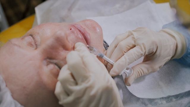 Belotero Lips CONTOUR смотреть онлайн