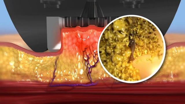 BodyFX смотреть онлайн