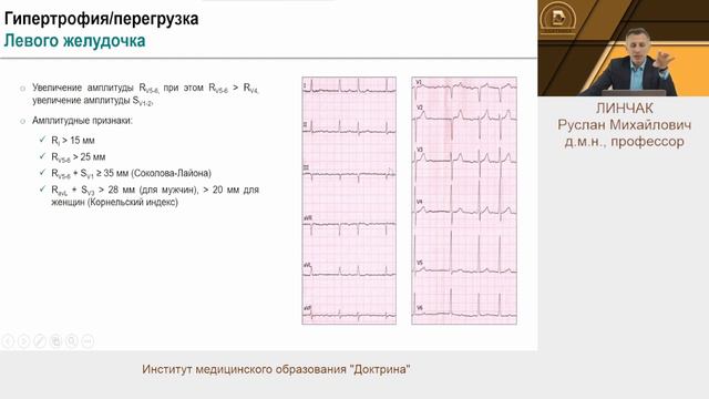 Гипертрофия/ перегрузка камер сердца