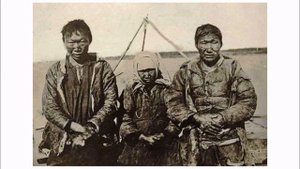 Колония прокаженных. Как в России узнали о лепре.