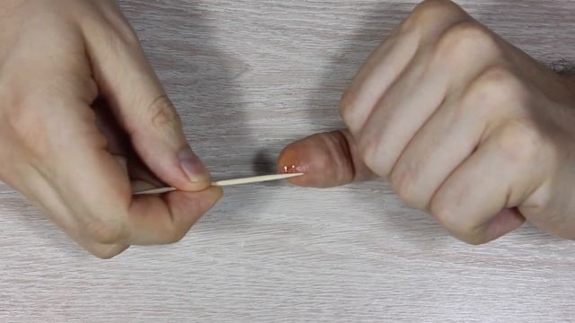 Как Быстро Залечить Порез или Рану смотреть онлайн