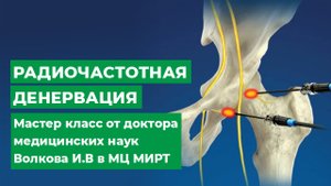 Радиочастотная денервация в МЦ МИРТ.