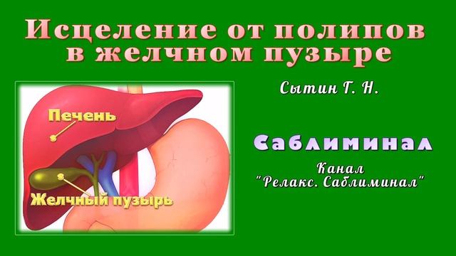 Народное лечение полипа в желчном пузыре. Лекарство от полипов в желчном. Лекарства от полипов в желчном пузыре. Сытин г,н исцеление от полипов в желчном пузыре. Полип желчного пузыря мкб.