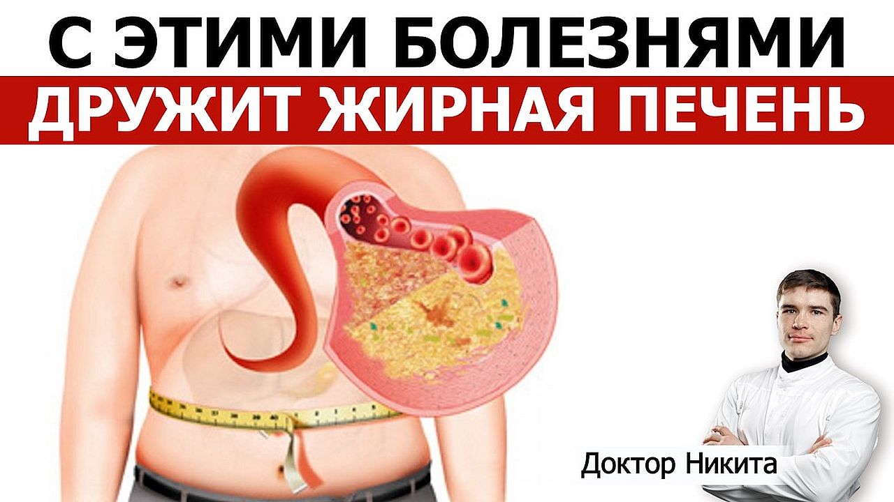 С какими болезнями дружит жирная печень. При каких диагнозах ожирение печени встречается часто
