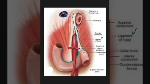 SUSPENSORY MUSCLE OF DUODENUM OR LIGAMENT OF TREITZ