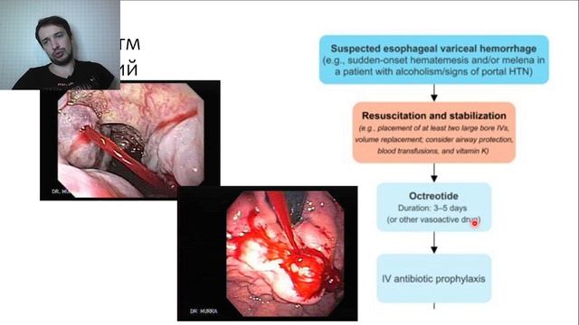 Хирургия печени. Лекция. смотреть онлайн