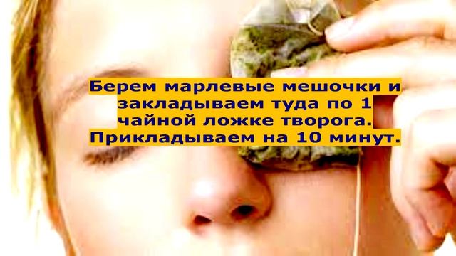 Убираем круги под глазами смотреть онлайн