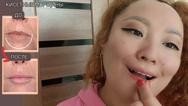 Убрать Носогубные Складки КИСЕТНЫЕ МОРЩИНЫ Тейпирование верхней губы смотреть онлайн