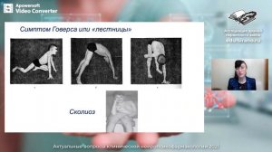 Мышечная дистрофия Дюшенна. Лектор доцент РМАНПО Н.В. Чебаненко