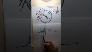 ЭКГ (зубец P, интервал P-Q, комплекс QRS)
