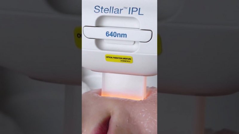 Stellar IPL: как работает мультиимпулс? #аппаратнаякосметология #обучениекосметологов