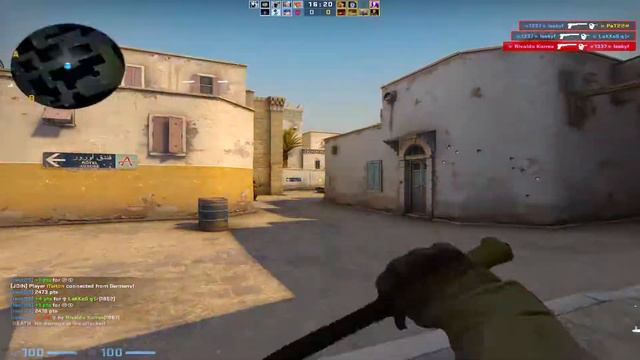 ТАЛАНТА НЕ СУЩЕСТВУЕТ (CS:GO) смотреть онлайн