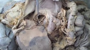 ветви грудной и брюшной частей аорты