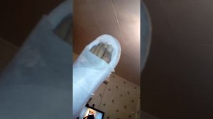 Перелом лодыжки или малой кости.