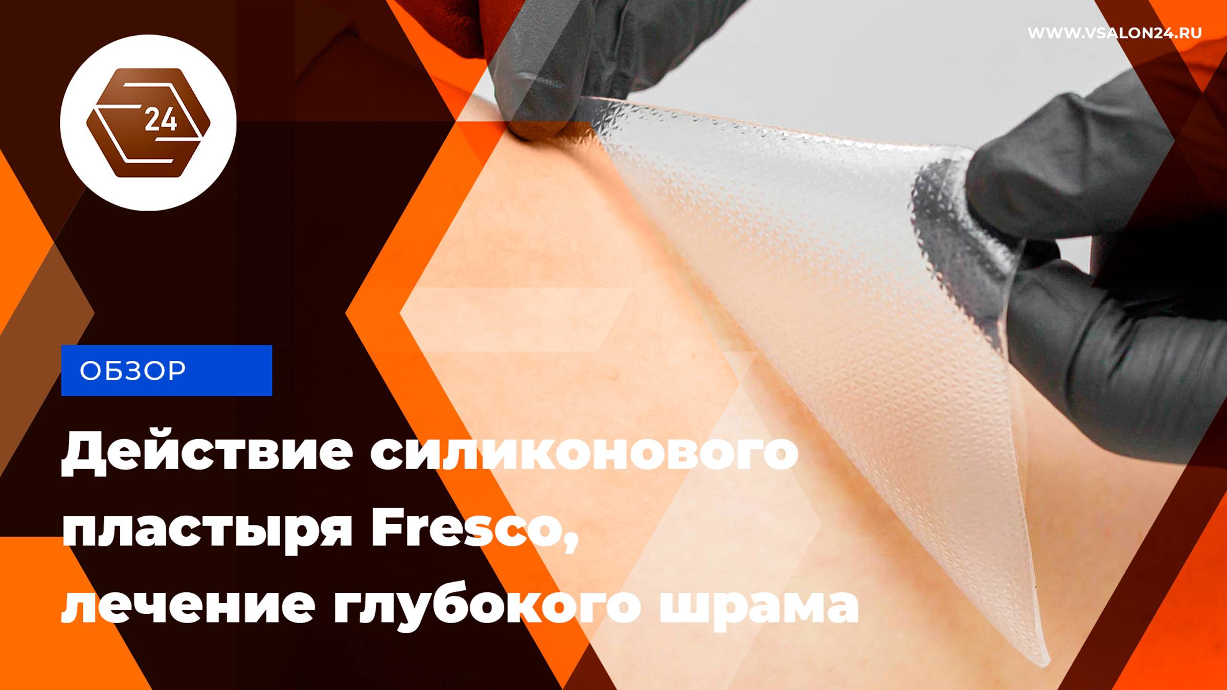 Действие маскирующего силиконового пластыря-накладки Fresco Dainamed на состояние шрамов и рубцов