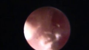 Новообразование (полип) в слуховом проходе у кошки.