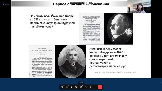 Хроническая сердечная недостаточность, современный взгляд на проблему смотреть онлайн