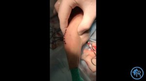 Вывих коленной чашечки и разрыв ПКС у собаки