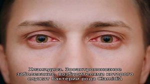 У собаки красные глаза: почему и что делать