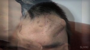 5 НЕВЕРОЯТНЫХ СУПЕР ОПЕРАЦИЙ