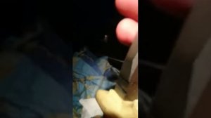 Как вытащить рыбацкий крючок из пальца