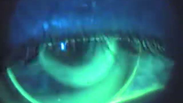 NH OD 46 50 11 0 5 25 1 day смотреть онлайн