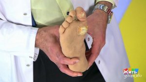 Гадаем по ногам. Что ваши ноги говорят о здоровье? Жить здорово! Фрагмент выпуска от 09.07.2018