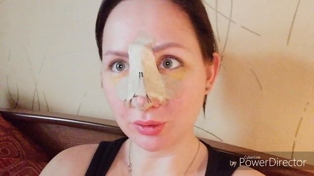 Септопластика и ринопластика