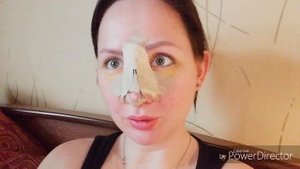 Септопластика и ринопластика