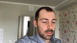 Три месяца после пересадки волос в Турции