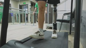 Ампутация не приговор!