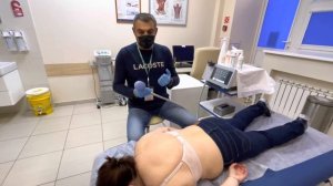 Ударно-волновая терапия - лечим «вдовьий горбик», «холку», или климактерический горб.