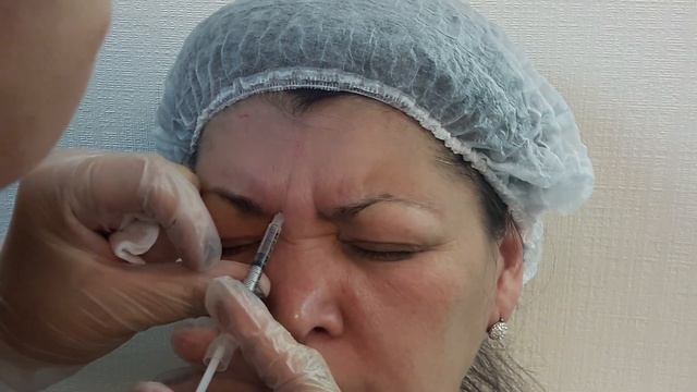 Аириском студенты учатся: практика студентов по ботоксу. смотреть онлайн