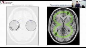 Взгляд на ЭЭГ с точки зрения доказательной медицины и психиатрические аспекты эпилепсии