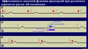Как работает наше сердце. Часть 5. Работа сердца при различной ЧСС и аритмиях.
