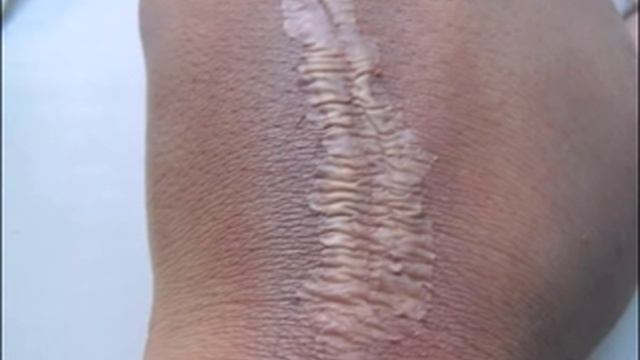 Как сделать рану на Хэллоуин.How to make a cut on Halloween. смотреть онлайн